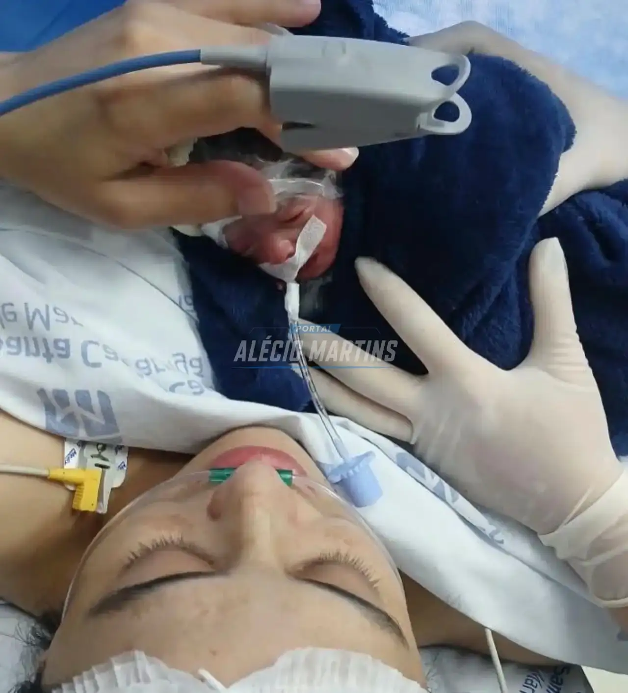 Após gestação rara, quadrigêmeas de Sarandi nascem em parto antecipado