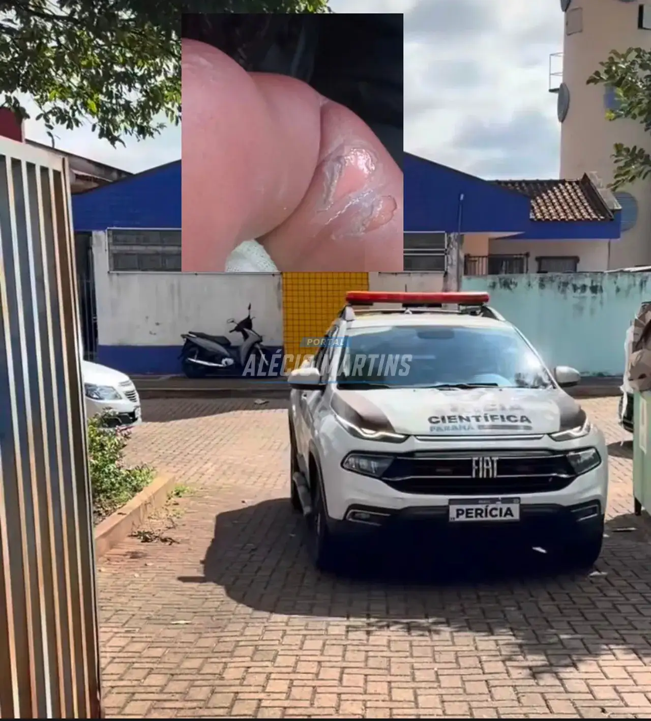 Bebê de oito meses sofre queimaduras após falha em chuveiro de CMEI em Sarandi