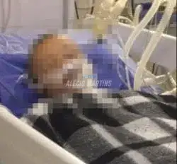 Criança sofre queimaduras graves com óleo quente em Maringá. Ela será transferida para hospital especializado em queimados