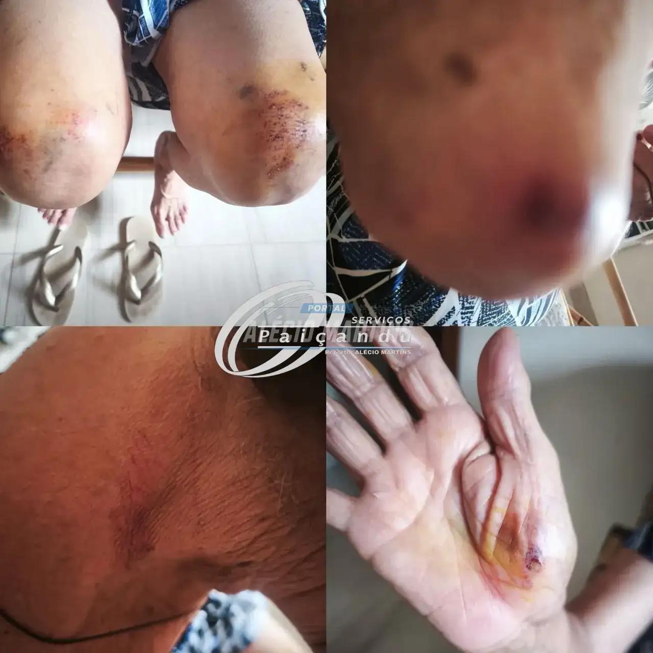Idosa de 76 é agredida e arrastada no chão durante tentativa de roubo em Paiçandu. “Isso não se faz nem com um animal” relatou a vítima