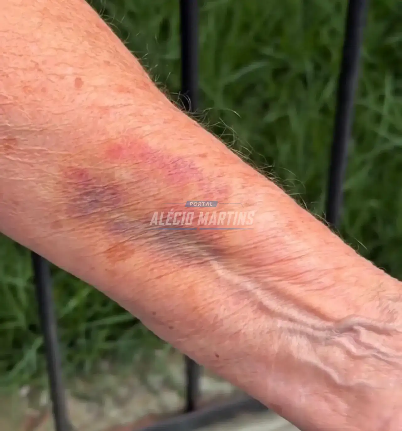 Idosa de 76 anos atacada durante tentativa de assalto presta depoimento em Paiçandu